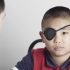 Difference between patching and vision therapy for lazy eye (amblyopia)